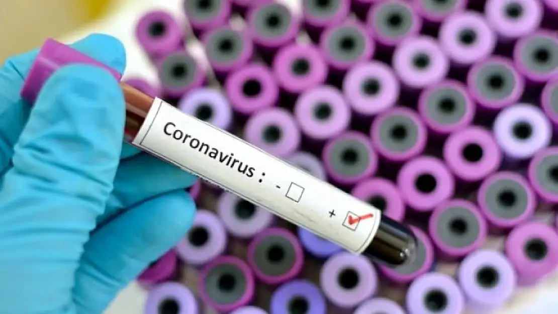 'Koronavirüse Yönelik Desteklenen 14 Projenin Maliyeti 18 Milyon Lira'