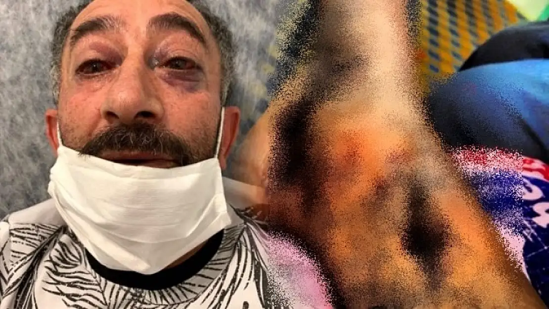 15 Temmuz Gazisinin Yürek Burkan Dramı!