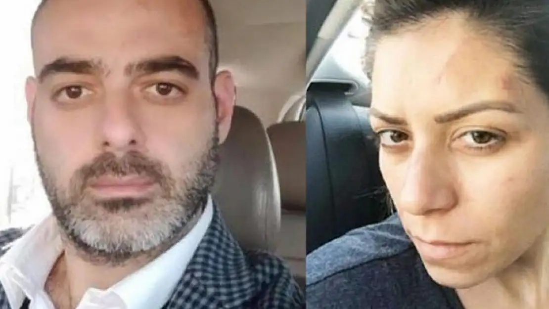 Avukat Eşine Şiddet Uygulayan Kişi Ev Hapsinde Öldürüldü