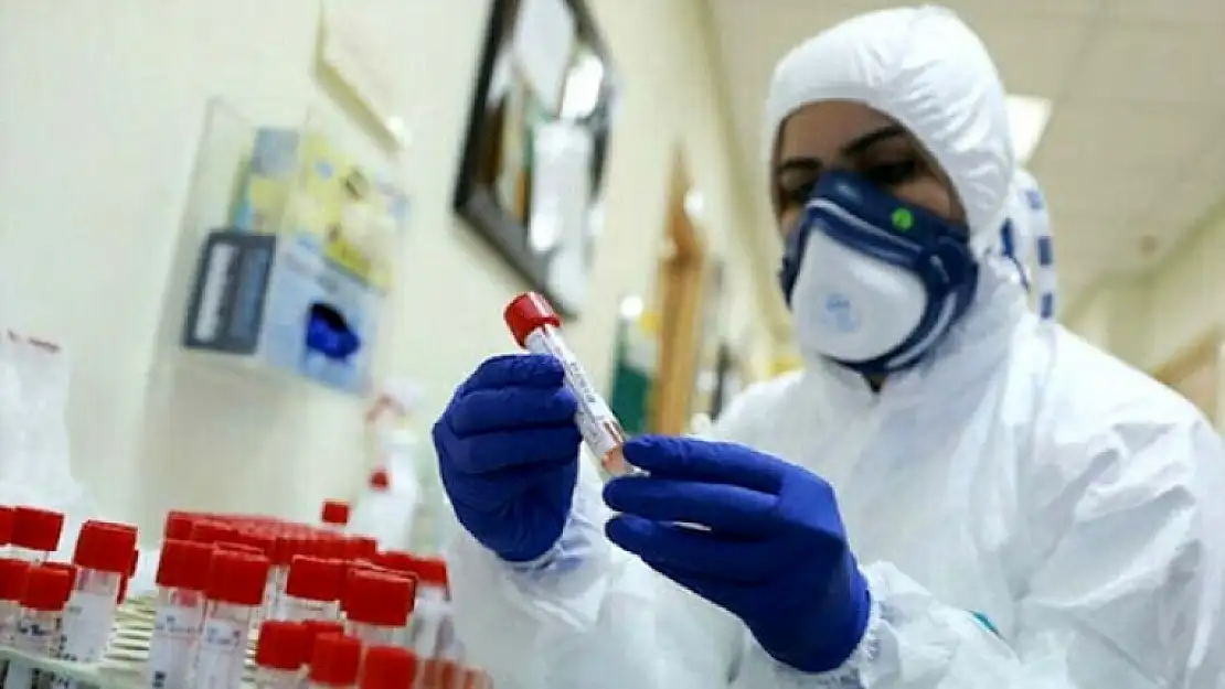 Türkiye'nin Koronavirüs Tablosu: 57 Vefat, 1429 Yeni Hasta