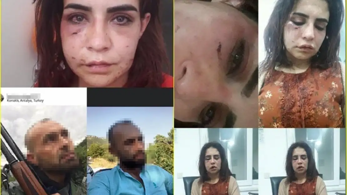 Eski Sevgilisi Tarafından Öldüresiye Dövülen Beyza'dan Tardım Çığlığı: 'Ölmek İstemiyorum'
