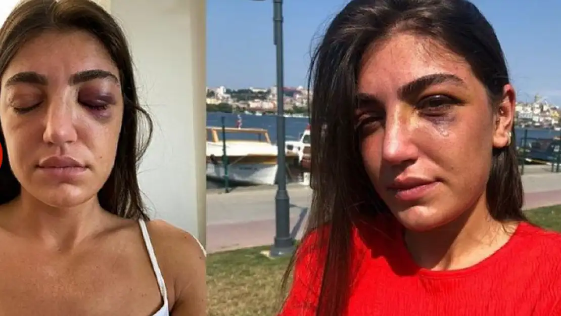 Genç Mankeni Eski Sevgilisi Öldüresiye Dövdü