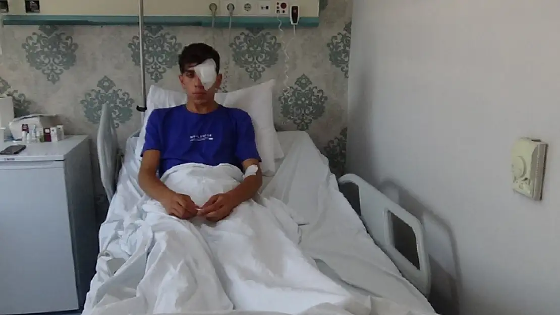 Rastgele Atılan Maytap, 17 Yaşındaki Genci Gözünden Etti