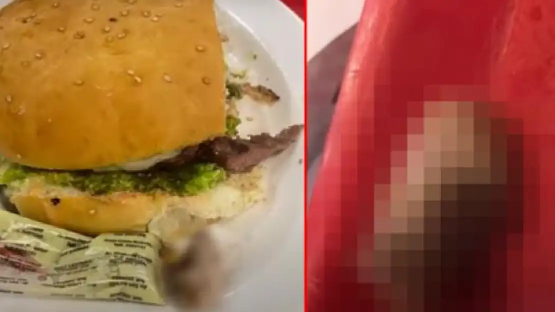 Bir Garip Olay: Hamburgerden İnsan Parmağı Çıktı!