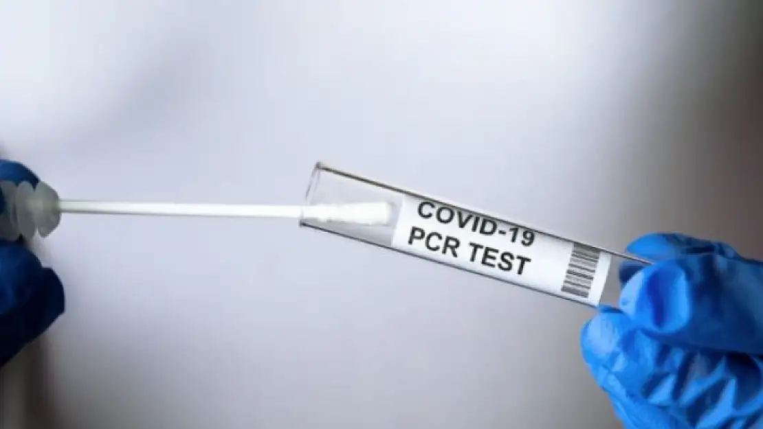 İşveren, PCR Testi Yaptırmayanı İşten Çıkartabilir Mi?