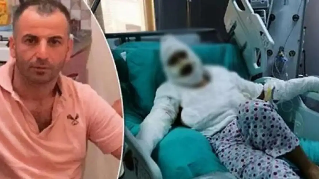 Genç Kadını İstismar Edip Kızgın Yağla Yakan Şahıs Tahliye Edildi