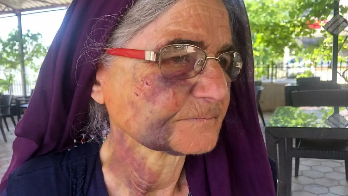 Kuzusunu Sürüden Almak İsterken Dayak Yedi, Yüzü Tanınmaz Hale Geldi