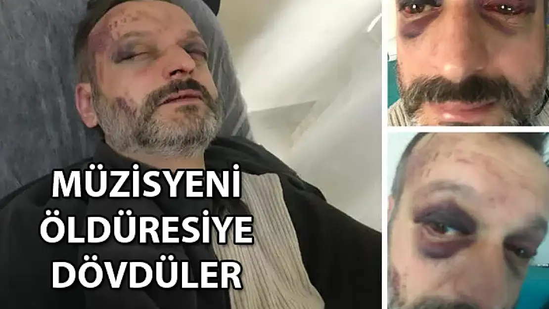 İstedikleri Çiftetelliyi Hemen Çalmadı Diye Müzisyeni Dövdüler