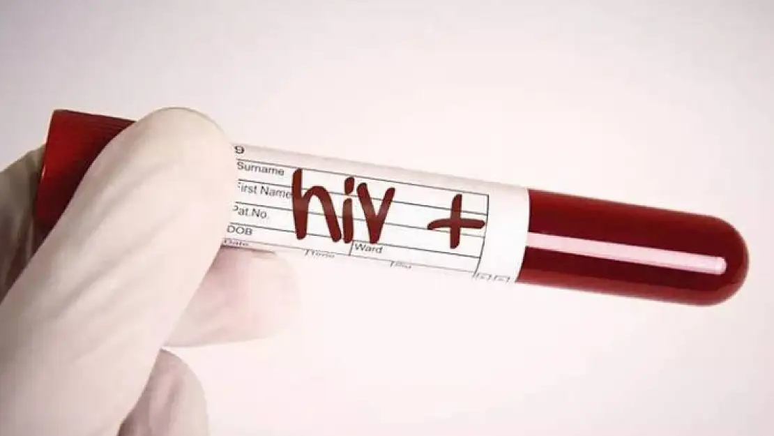 AMELİYAT OLAN HASTAYA VERİLEN KANDA HIV TESPİT EDİLDİ