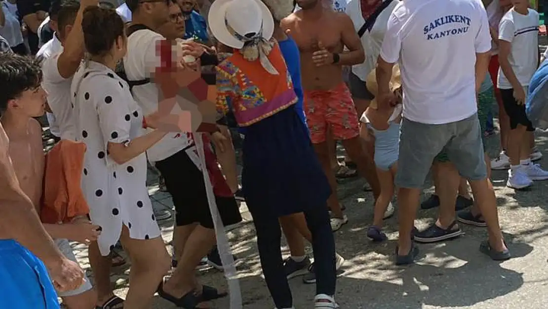 Saklıkent Kanyonu'nda 3 yaşındaki çocuğun kafasına taş düşünce ağır yaralandı