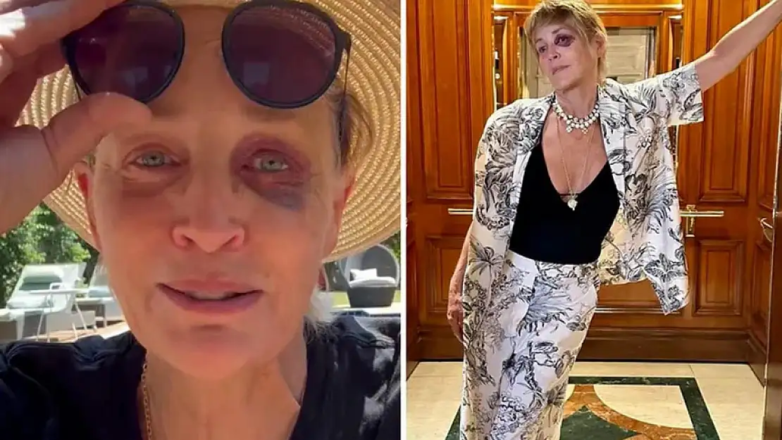 SHARON STONE'UN BAŞINA GELEN TALİHSİZ KAZA ŞAŞKINLIK YARATTI! KAZA DEĞİL, DAYAK YEMİŞ GİBİ GÖRÜNÜYOR