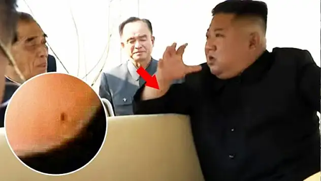 Kuzey Kore Lideri Kim Jong-un Kalp Ameliyatı Olmuş Olabilir!